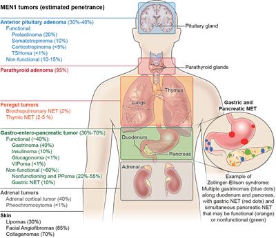 Familial Hyperparathyroidism